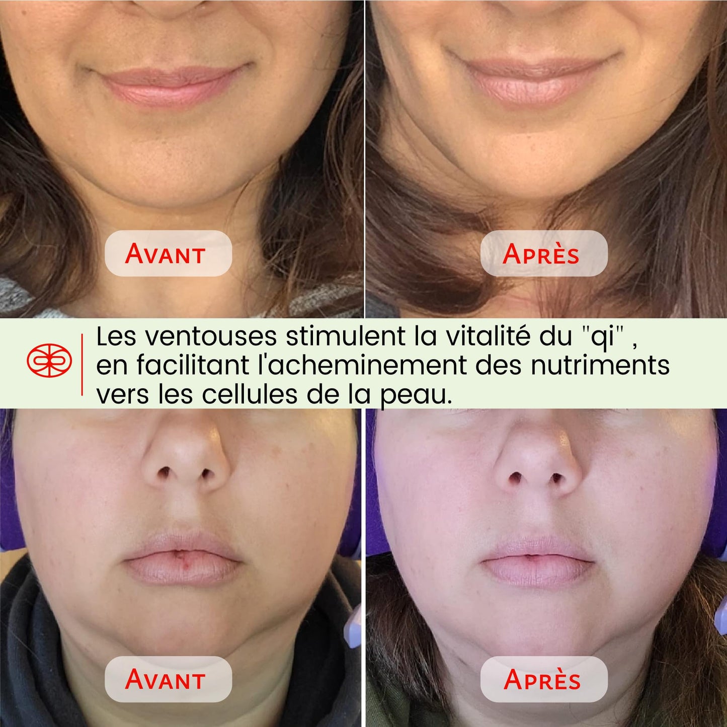 Rena Chris Ventouse Visage & Outil Gua Sha - Set de Ventouses en Silicone & Pierre Gua Sha en Quartz Rose, Soin Naturel, Réduit Gonflements, Repulpe les Lèvres (Rose)